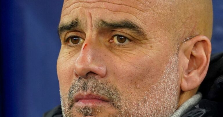 «Quiero lastimarme a mí mismo»: Pep Guardiola pidió perdón tras la polémica frase sobre las heridas en su nariz y en su cabeza